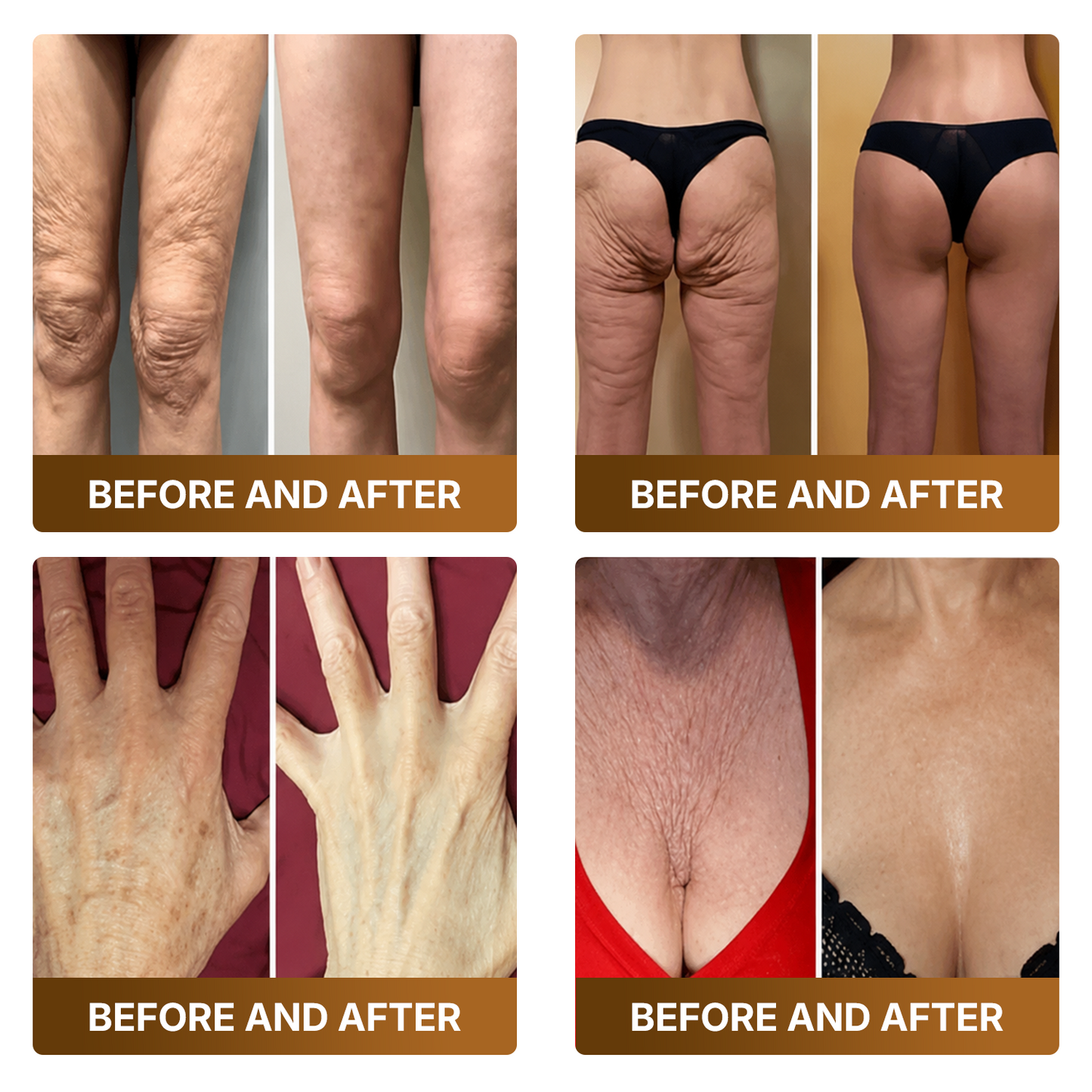 【Made and Shipped from UK 】🚑DOCTIA® Botox & Bee Venom Advanced Recovery Cream—For Wrinkles, Sagging Skin, Skin Tags & Rough Bumps⚡